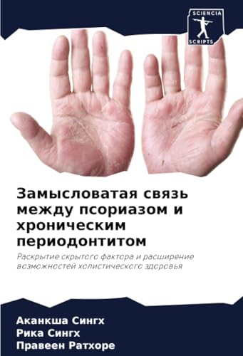Замысловатая связь между псориазом и хроническим периодонтитом: Раскрытие скрытого фактора и расширение возможностей холистического здоровья: ... wozmozhnostej holisticheskogo zdorow'q von Sciencia Scripts