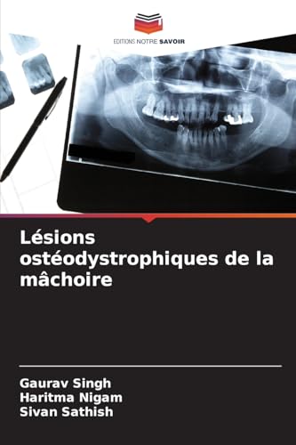 Lésions ostéodystrophiques de la mâchoire von Editions Notre Savoir