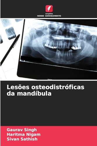 Lesões osteodistróficas da mandíbula: DE von Edições Nosso Conhecimento