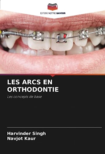 LES ARCS EN ORTHODONTIE: Les concepts de base von Editions Notre Savoir