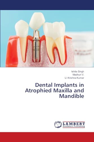 Dental Implants in Atrophied Maxilla and Mandible von LAP LAMBERT Academic Publishing