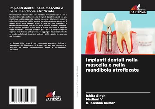 Impianti dentali nella mascella e nella mandibola atrofizzate von Edizioni Sapienza