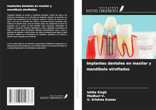 Implantes dentales en maxilar y mandíbula atrofiados von Ediciones Nuestro Conocimiento
