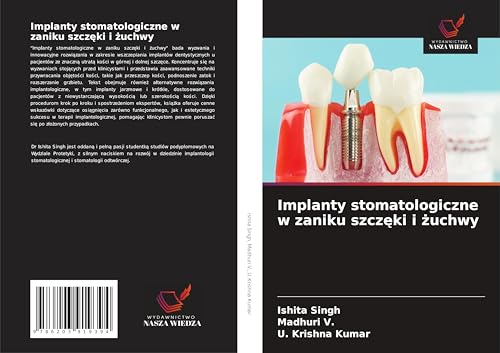 Implanty stomatologiczne w zaniku szcz¿ki i ¿uchwy: DE von Wydawnictwo Nasza Wiedza