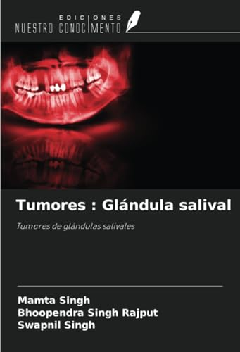 Tumores : Glándula salival: Tumores de glándulas salivales von Ediciones Nuestro Conocimiento