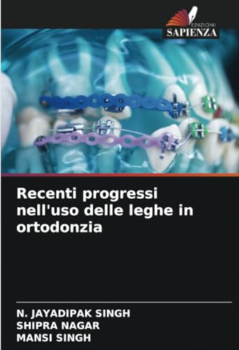 Recenti progressi nell'uso delle leghe in ortodonzia von Edizioni Sapienza