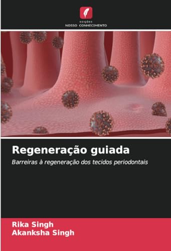 Regeneração guiada: Barreiras à regeneração dos tecidos periodontais von Edições Nosso Conhecimento