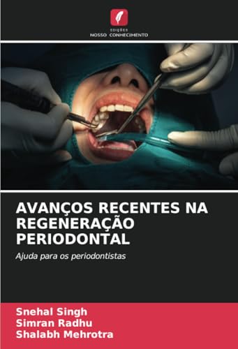 AVANÇOS RECENTES NA REGENERAÇÃO PERIODONTAL: Ajuda para os periodontistas von Edições Nosso Conhecimento