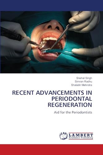 RECENT ADVANCEMENTS IN PERIODONTAL REGENERATION: Aid for the Periodontists von LAP LAMBERT Academic Publishing