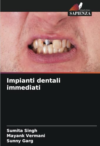 Impianti dentali immediati von Edizioni Sapienza