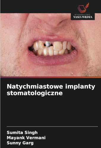Natychmiastowe implanty stomatologiczne: DE von Wydawnictwo Nasza Wiedza
