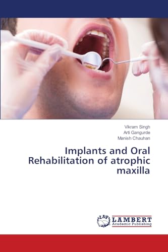 Implants and Oral Rehabilitation of atrophic maxilla: DE von LAP LAMBERT Academic Publishing