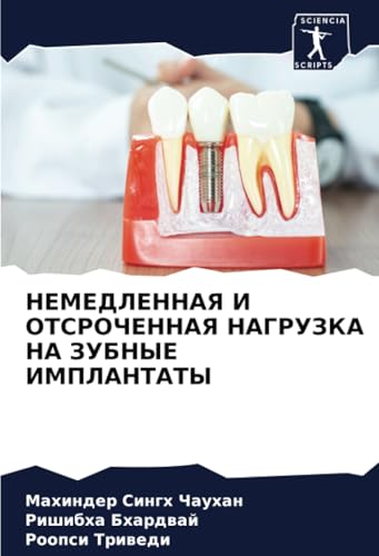 НЕМЕДЛЕННАЯ И ОТСРОЧЕННАЯ НАГРУЗКА НА ЗУБНЫЕ ИМПЛАНТАТЫ: DE von Sciencia Scripts