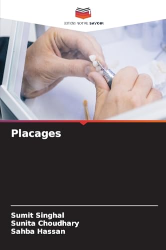 Placages: DE