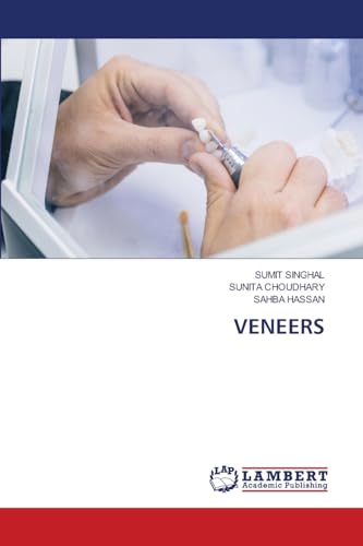 VENEERS: DE von LAP LAMBERT Academic Publishing