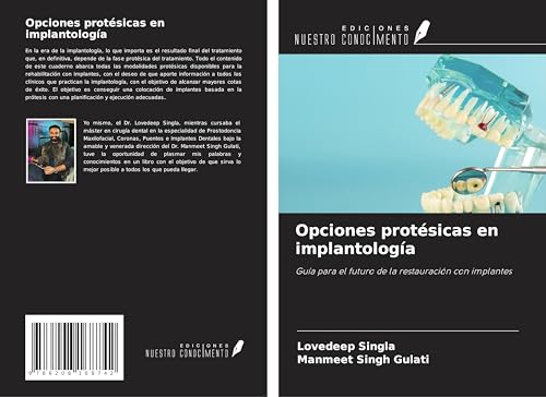 Opciones protésicas en implantología: Guía para el futuro de la restauración con implantes