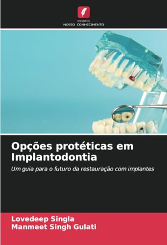 Opções protéticas em Implantodontia: Um guia para o futuro da restauração com implantes Opções protéticas em Implantodontia: Um guia para o futuro da restauração com implantes