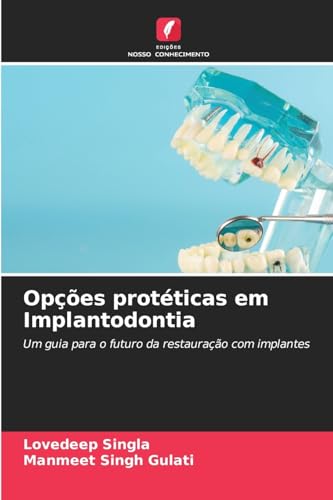 Opções protéticas em Implantodontia: Um guia para o futuro da restauração com implantes