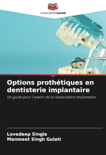 Options prothétiques en dentisterie implantaire: Un guide pour l'avenir de la restauration implantaire von Editions Notre Savoir