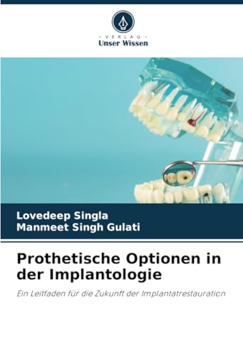 Prothetische Optionen in der Implantologie: Ein Leitfaden für die Zukunft der Implantatrestauration von Verlag Unser Wissen