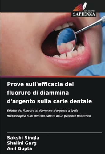 Prove sull'efficacia del fluoruro di diammina d'argento sulla carie dentale: Effetto del fluoruro di diammina d'argento a livello microscopico sulla dentina cariata di un paziente pediatrico von Edizioni Sapienza