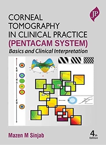 Corneal Tomography in Clinical Practice Pentacam System: Basics and Clinical Interpretation