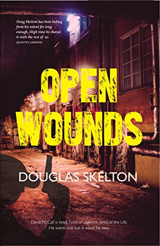 Open Wounds (Davie Mccall, Band 4) von Luath Press Limited