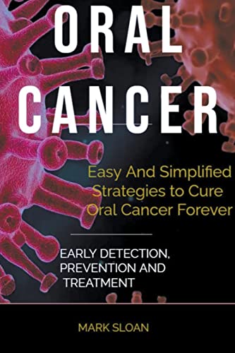 Oral Cancer: Easy And Simplified Strategies to Cure Oral Cancer Forever : Early Detection, Prevention And Treatment von Gordon Nsowine
