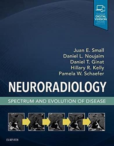 Neuroradiology: Spectrum and Evolution of Disease: Spectrum and Evolution of Disease Neuroradiology: Spectrum and Evolution of Disease: Spectrum and Evolution of Disease