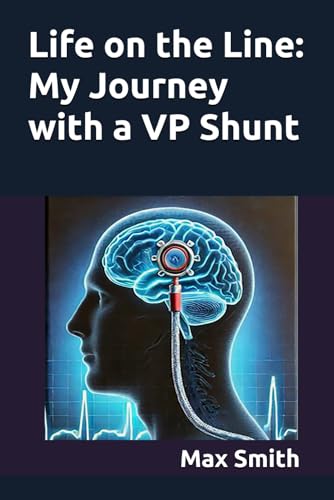 Life on the Line: My Journey with a VP Shunt von Independently published
