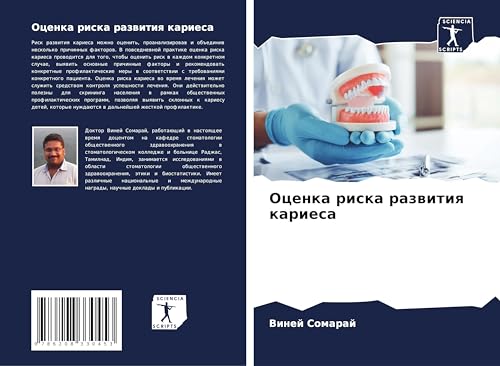 Ocenka riska razwitiq kariesa: DE von Sciencia Scripts