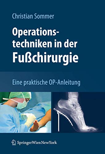 Operationstechniken in der Fußchirurgie: Eine praktische OP-Anleitung
