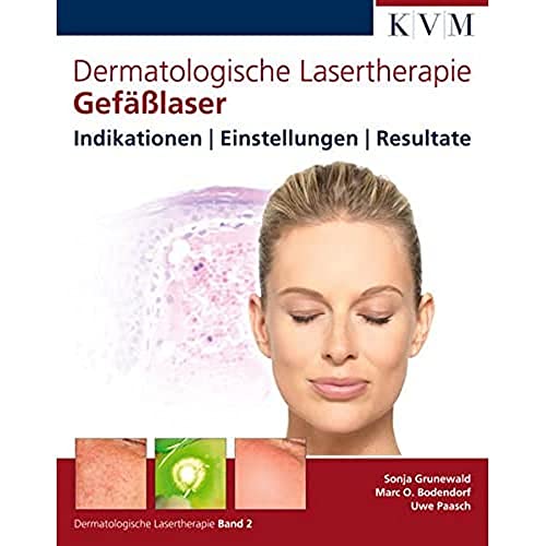 Dermatologische Lasertherapie Band 2: Gefäßlaser: Indikationen - Einstellungen - Resultate Dermatologische Lasertherapie Band 2: Gefäßlaser: Indikationen - Einstellungen - Resultate von KVM-Der Medizinverlag