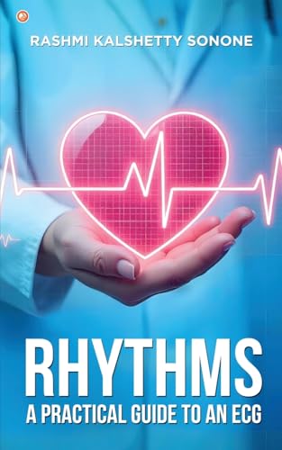Rhythms: A practical guide to an ECG Rhythms: A practical guide to an ECG von OrangeBooks Publication