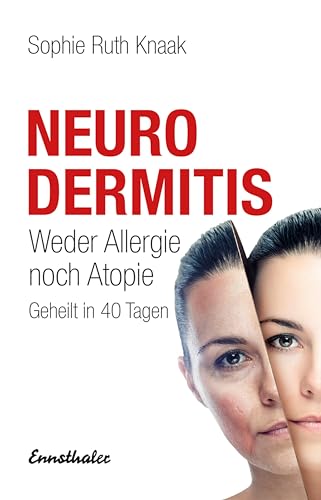 Neurodermitis: Weder Allergie noch Atopie - Geheilt in 40 Tagen von Ennsthaler GmbH + Co. Kg