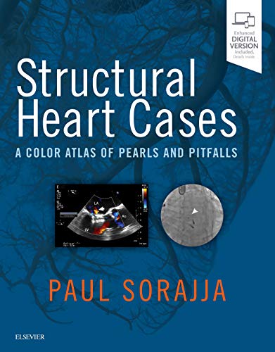 Structural Heart Cases: A Color Atlas of Pearls and Pitfalls