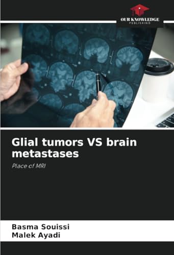 Glial tumors VS brain metastases: Place of MRI von Our Knowledge Publishing