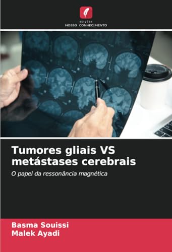 Tumores gliais VS metástases cerebrais: O papel da ressonância magnética von Edições Nosso Conhecimento