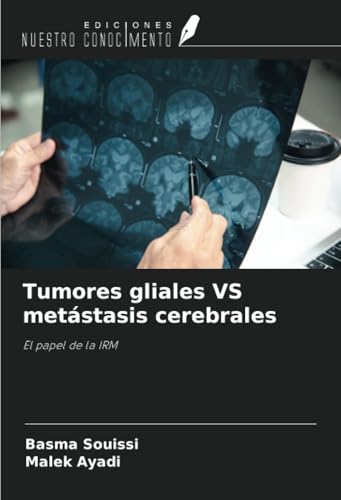 Tumores gliales VS metástasis cerebrales: El papel de la IRM von Ediciones Nuestro Conocimiento