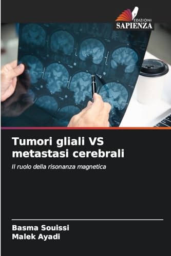 Tumori gliali VS metastasi cerebrali: Il ruolo della risonanza magnetica von Edizioni Sapienza