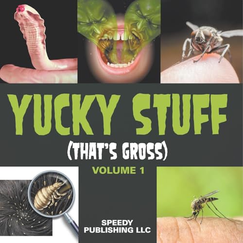 Yucky Stuff (That's Gross Volume 1) von Speedy Publishing LLC