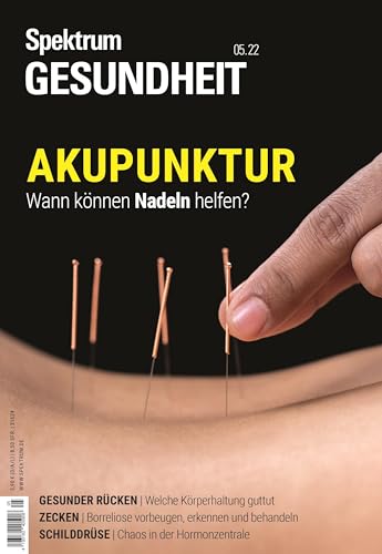Spektrum Gesundheit- Akupunktur: Wann können Nadeln helfen?
