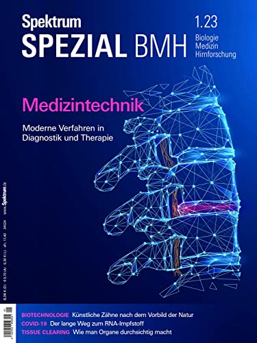 Spektrum Spezial - Medizintechnik: Moderne Verfahren in Diagnostik und Therapie (Spektrum Spezial - Biologie, Medizin, Hirnforschung)