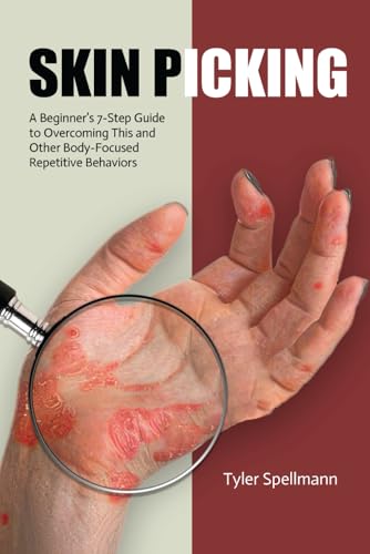 Skin Picking: A Beginner’s 7-Step Guide to Overcoming This and Other Body-Focused Repetitive Behaviors von Independently published
