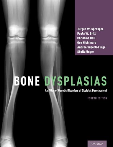 Bone Dysplasias: An Atlas of Genetic Disorders of Skeletal Development von Oxford University Press, USA