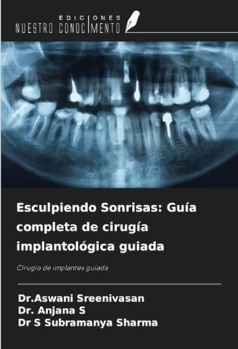 Esculpiendo Sonrisas: Guía completa de cirugía implantológica guiada: Cirugía de implantes guiada von Ediciones Nuestro Conocimiento
