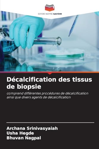 Décalcification des tissus de biopsie: comprend différentes procédures de décalcification ainsi que divers agents de décalcification von Editions Notre Savoir