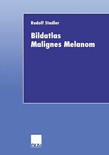 Bildatlas Malignes Melanom von Springer