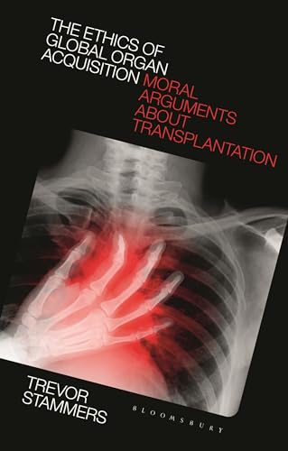 The Ethics of Global Organ Acquisition: Moral Arguments about Transplantation von Bloomsbury Academic