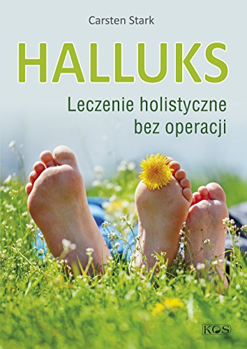 Halluks: Leczenie holistyczne bez operacji von Kos